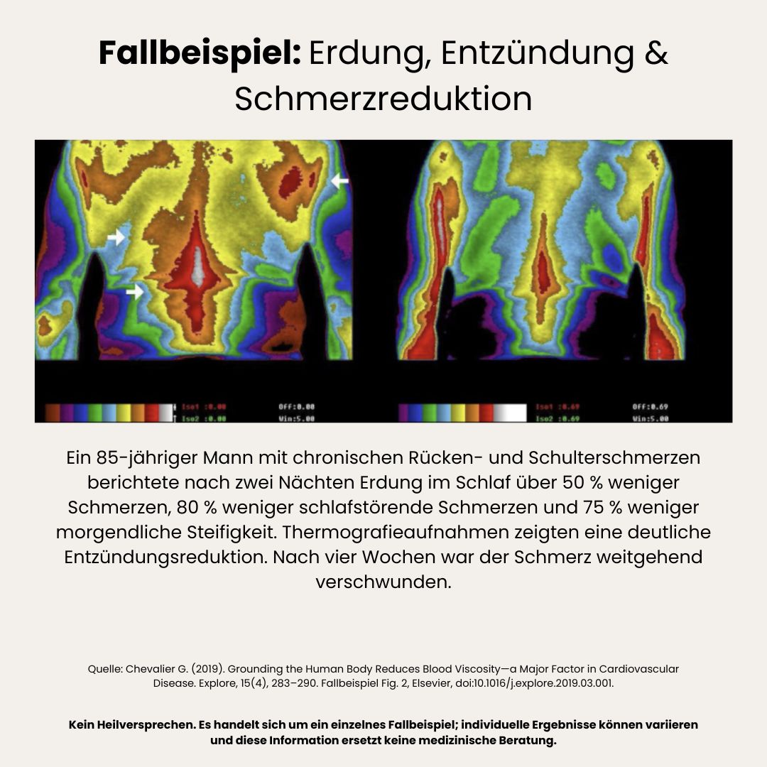 Erdungslaken · FLEX