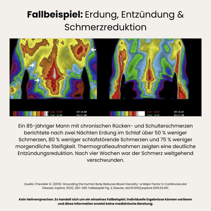 Erdungslaken · FLEX